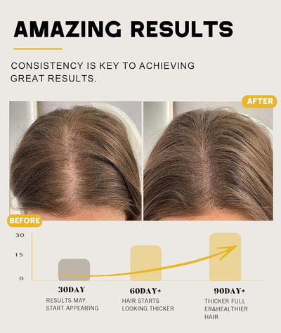 Qytin Batana Oil for Hair Growth, 100% Natural Pure Batana Oil Paste from Dr. Sebi Honduras, Prevents Hair Loss, Enhances Thickness, Organic Raw Batana Hair...