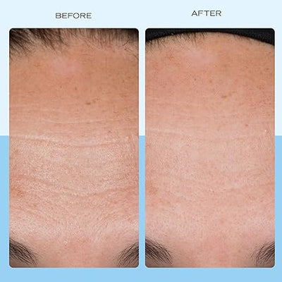 First Aid Beauty - Firming Collagen Cream with Peptides & Niacinamide, Ultra-Rich Plumping Moisturizer, Hydrates & Visibly Firms, Non-Comedogenic, Safe for Sensitive Skin, 3.5 oz